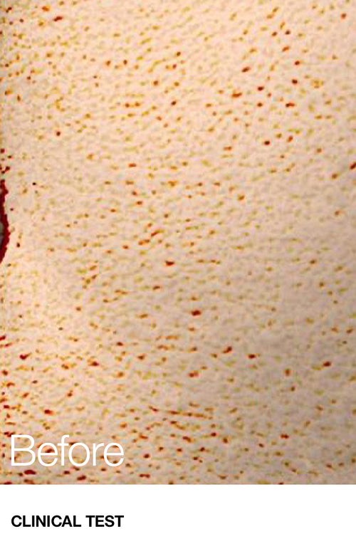 AnuaUS_HeartleafClearPad_862x1341_Before_Listing